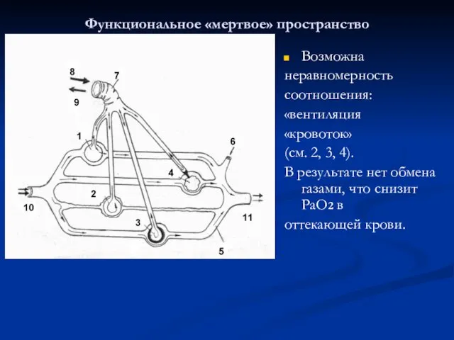 Функциональное «мертвое» пространство Возможна неравномерность соотношения: «вентиляция «кровоток» (см. 2,