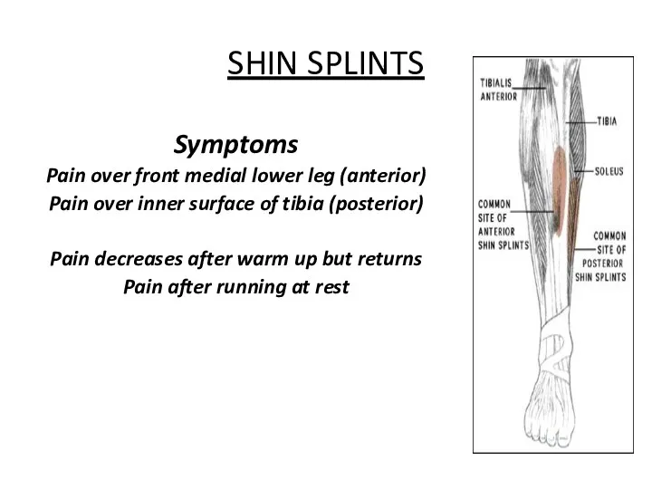 SHIN SPLINTS Symptoms Pain over front medial lower leg (anterior)