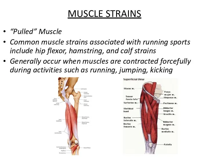 MUSCLE STRAINS “Pulled” Muscle Common muscle strains associated with running