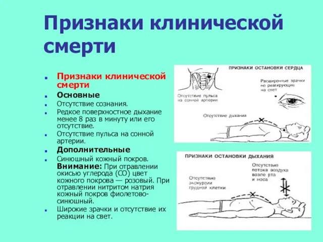 Признаки клинической смерти Признаки клинической смерти Основные Отсутствие сознания. Редкое