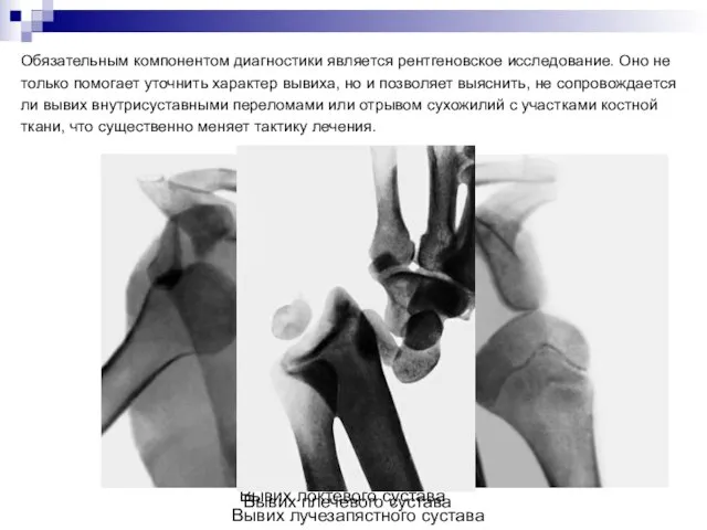 Обязательным компонентом диагностики является рентгеновское исследование. Оно не только помогает