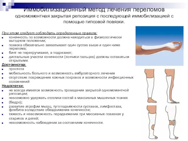 При этом следует соблюдать определенные правила: конечность по возможности должна