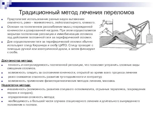 Традиционный метод лечения переломов Предполагает использование разных видов вытяжения: скелетного,