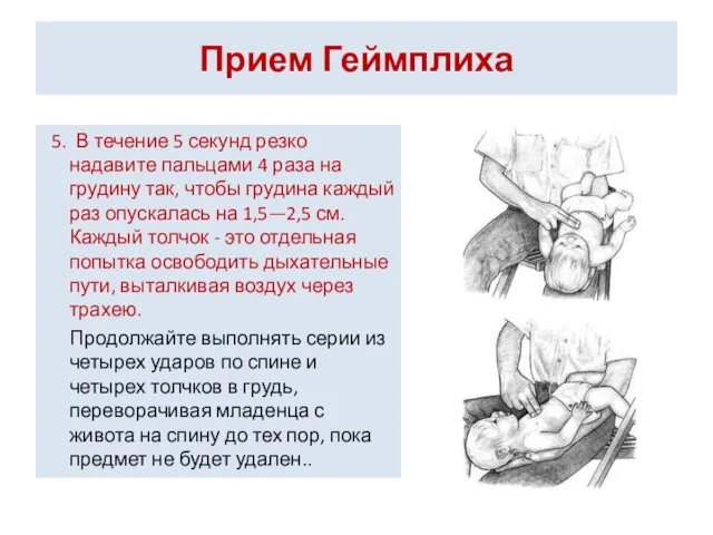 Прием Геймплиха 5. В течение 5 секунд резко надавите пальцами