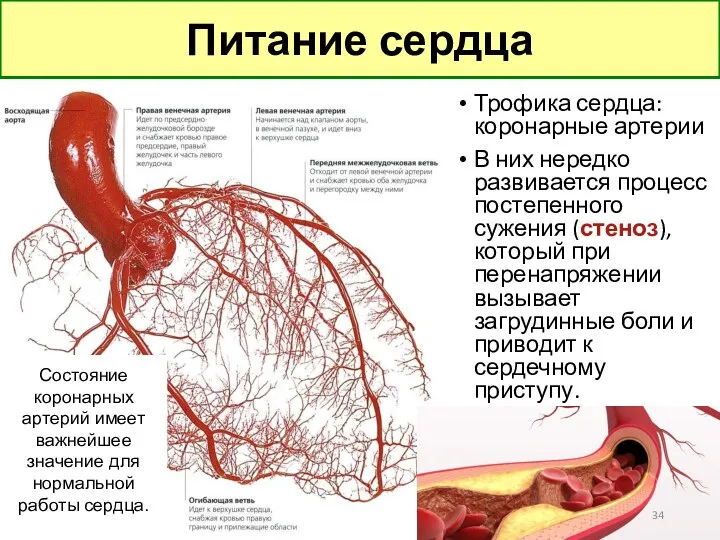 Трофика сердца: коронарные артерии В них нередко развивается процесс постепенного сужения (стеноз), который