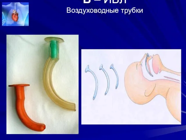 В – ИВЛ Воздуховодные трубки