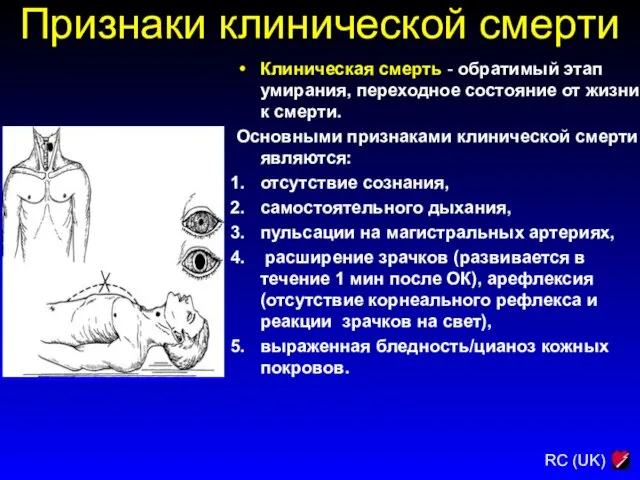 Признаки клинической смерти Клиническая смерть - обратимый этап умирания, переходное