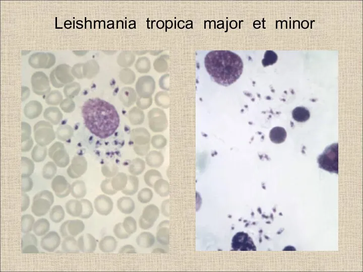 Leishmania tropica major et minor