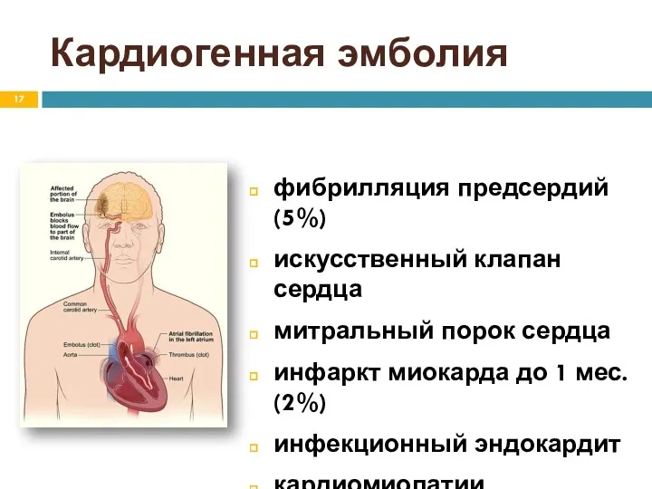 Кардиогенная эмболия фибрилляция предсердий (5%) искусственный клапан сердца митральный порок сердца инфаркт миокарда