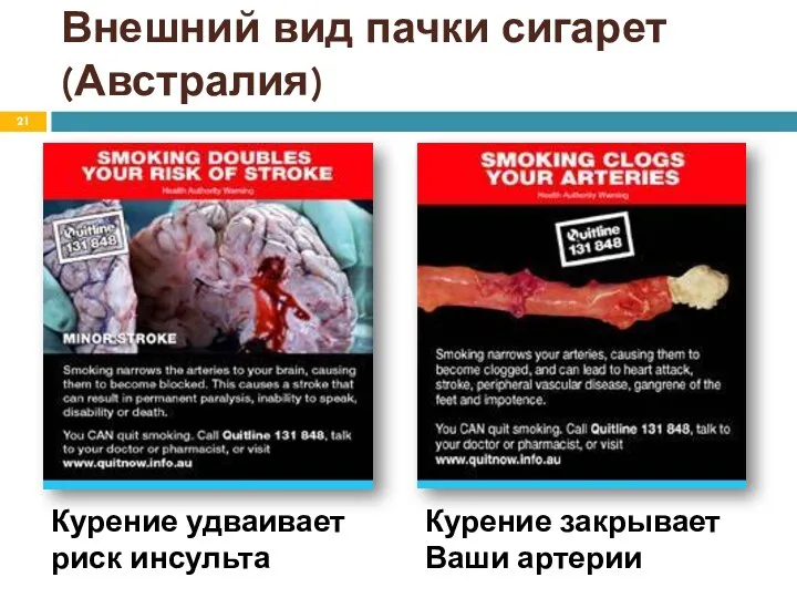 Курение удваивает риск инсульта Внешний вид пачки сигарет (Австралия) Курение закрывает Ваши артерии