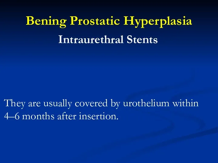 Bening Prostatic Hyperplasia Intraurethral Stents They are usually covered by urothelium within 4–6 months after insertion.