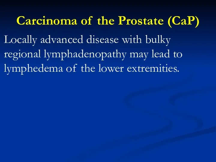 Carcinoma of the Prostate (CaP) Locally advanced disease with bulky