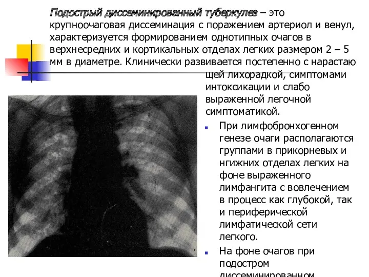 Подострый диссеминированный туберкулез – это крупноочаговая диссеминация с поражением артериол