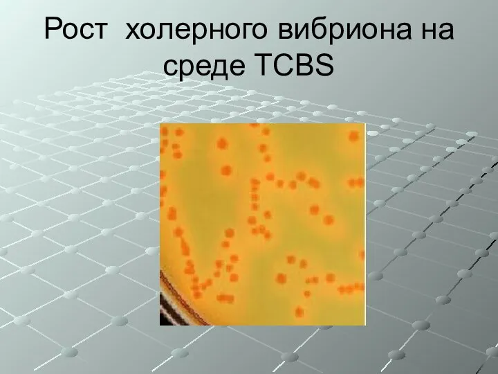 Рост холерного вибриона на среде TCBS
