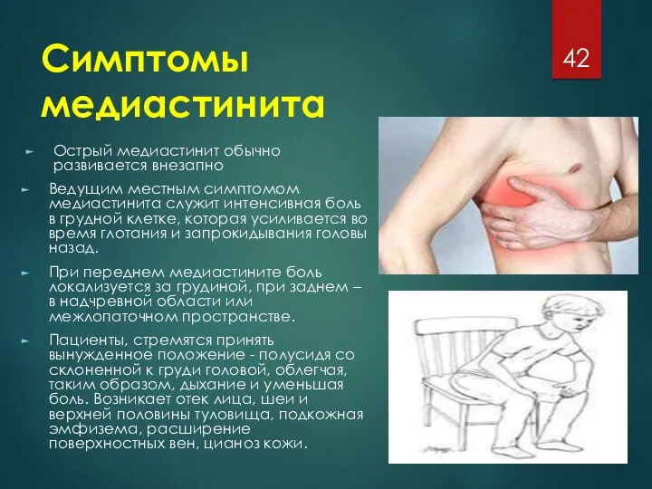 Симптомы медиастинита Острый медиастинит обычно развивается внезапно Ведущим местным симптомом