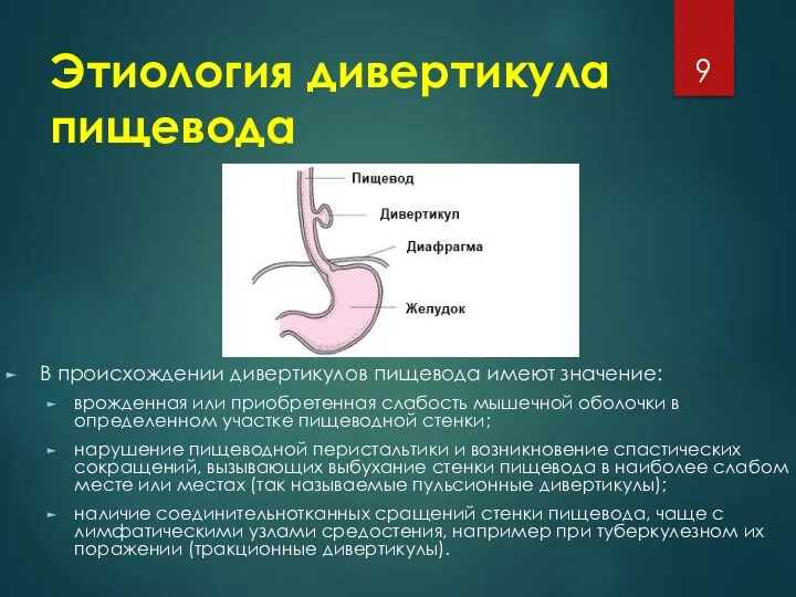 Этиология дивертикула пищевода В происхождении дивертикулов пищевода имеют значение: врожденная