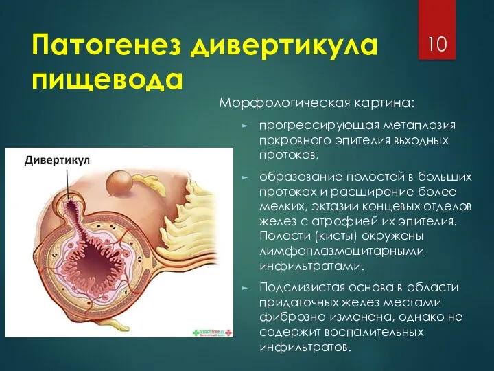 Патогенез дивертикула пищевода Морфологическая картина: прогрессирующая метаплазия покровного эпителия вьходных
