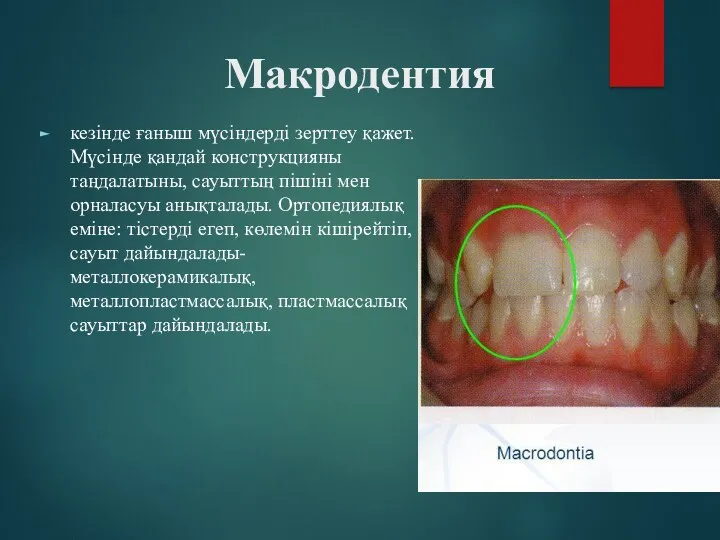 Макродентия кезінде ғаныш мүсіндерді зерттеу қажет. Мүсінде қандай конструкцияны таңдалатыны,