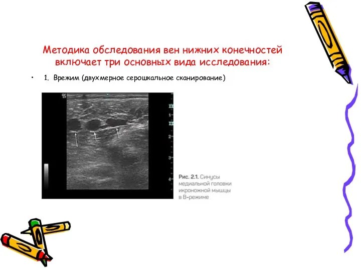 Методика обследования вен нижних конечностей включает три основных вида исследования: 1. В­режим (двухмерное серошкальное сканирование)