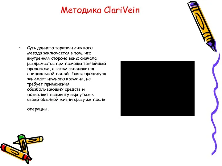 Методика ClariVein Суть данного терапевтического метода заключается в том, что