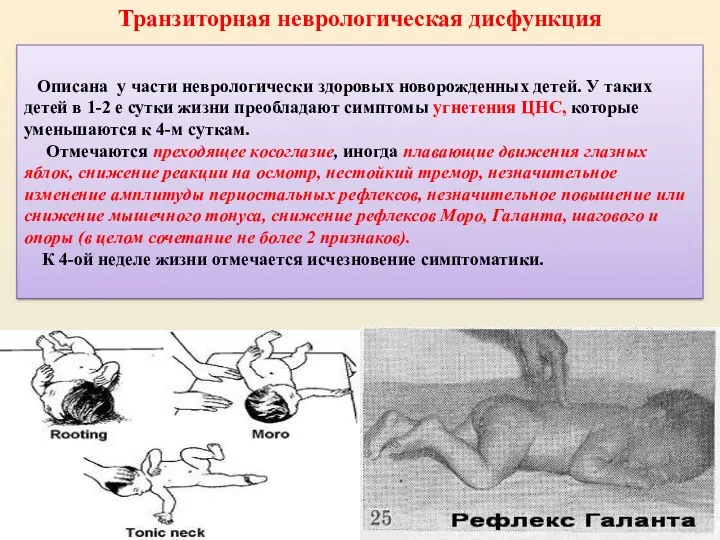 Описана у части неврологически здоровых новорожденных детей. У таких детей