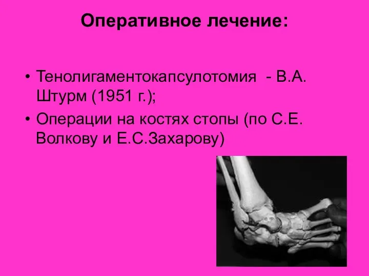 Оперативное лечение: Тенолигаментокапсулотомия - В.А.Штурм (1951 г.); Операции на костях стопы (по С.Е.Волкову и Е.С.Захарову)