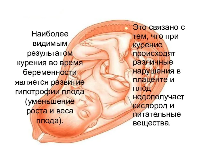 Наиболее видимым результатом курения во время беременности является развитие гипотрофии плода (уменьшение роста