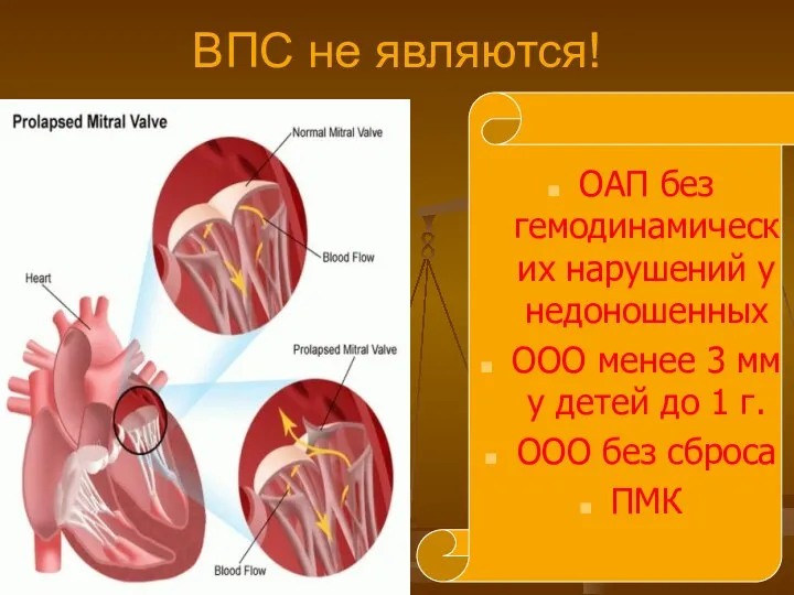 ВПС не являются! ОАП без гемодинамических нарушений у недоношенных ООО