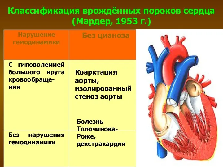 Классификация врождённых пороков сердца (Мардер, 1953 г.) Коарктация аорты, изолированный стеноз аорты Болезнь Толочинова-Роже, декстракардия