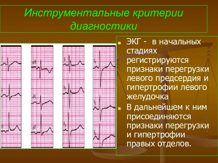 Инструментальные критерии диагностики ЭКГ - в начальных стадиях регистрируются признаки