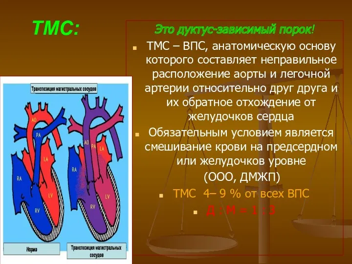 ТМС: Это дуктус-зависимый порок! ТМС – ВПС, анатомическую основу которого