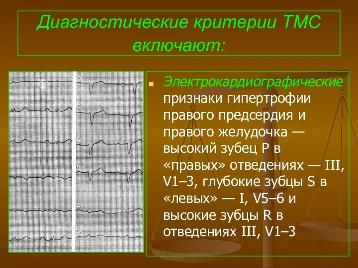 Диагностические критерии ТМС включают: Электрокардиографические признаки гипертрофии правого предсердия и