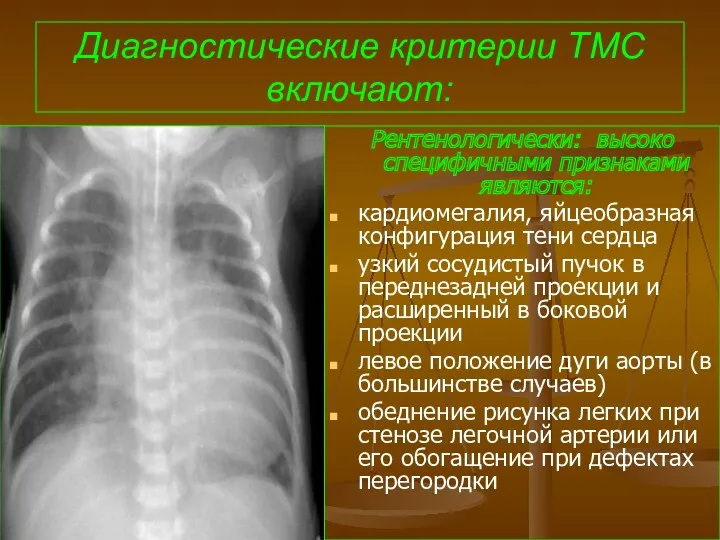 Диагностические критерии ТМС включают: Рентенологически: высоко специфичными признаками являются: кардиомегалия,