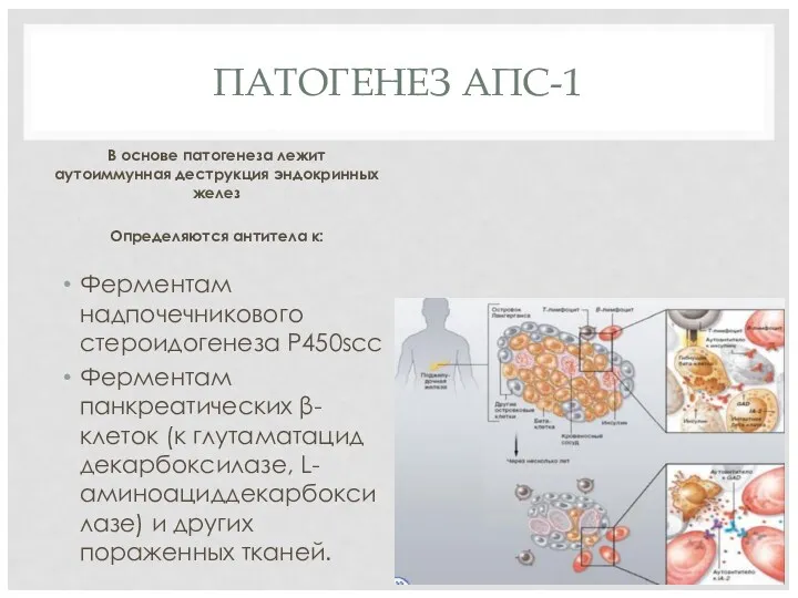 ПАТОГЕНЕЗ АПС-1 В основе патогенеза лежит аутоиммунная деструкция эндокринных желез