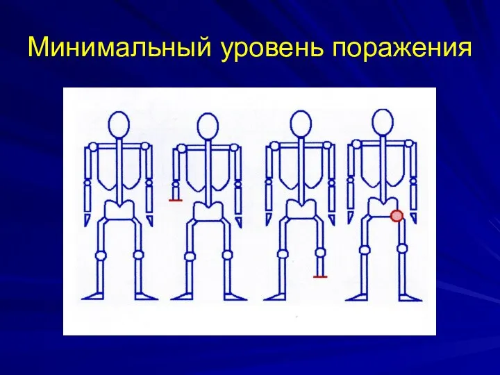 Минимальный уровень поражения