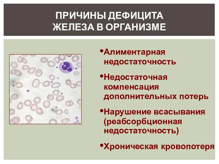 ПРИЧИНЫ ДЕФИЦИТА ЖЕЛЕЗА В ОРГАНИЗМЕ Алиментарная недостаточность Недостаточная компенсация дополнительных потерь Нарушение всасывания