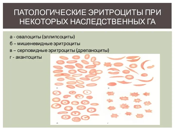 а - овалоциты (эллипсоциты) б – мишеневидные эритроциты в – серповидные эритроциты (дрепаноциты)