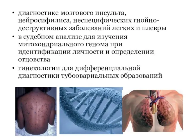 диагностике мозгового инсульта, нейросифилиса, неспецифических гнойно-деструктивных заболеваний легких и плевры