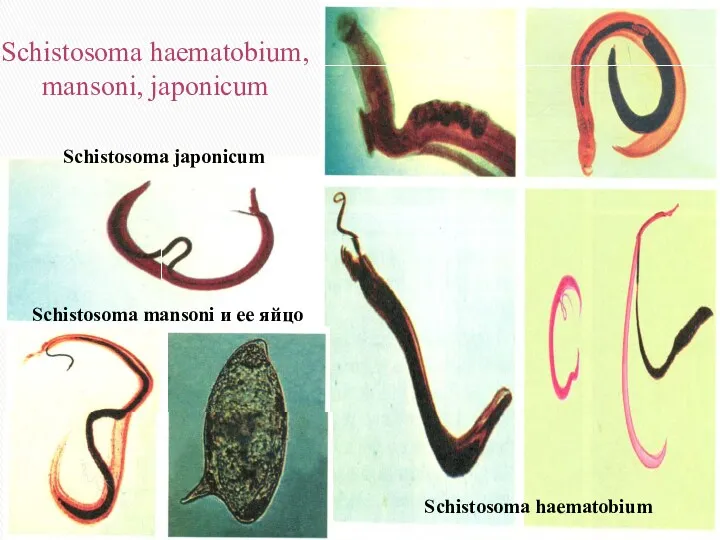 Schistosoma haematobium, mansoni, japonicum Schistosoma haematobium Schistosoma mansoni и ее яйцо Schistosoma japonicum