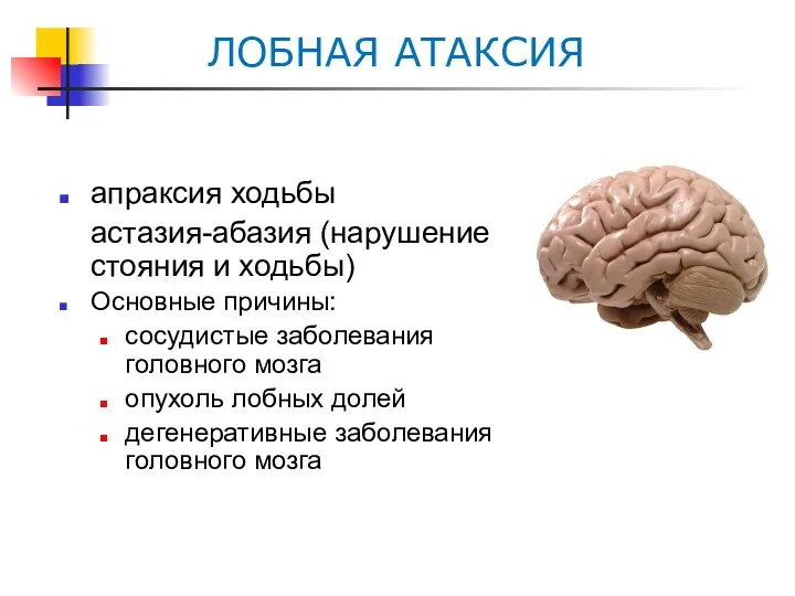 ЛОБНАЯ АТАКСИЯ апраксия ходьбы астазия-абазия (нарушение стояния и ходьбы) Основные