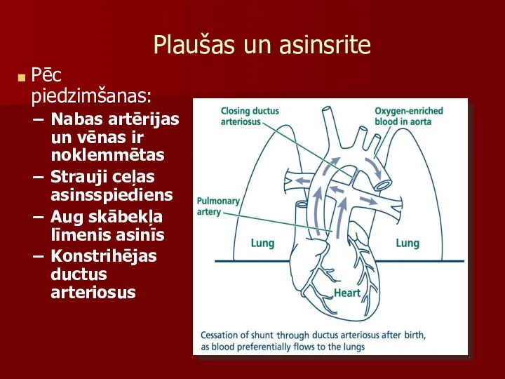 Plaušas un asinsrite Pēc piedzimšanas: Nabas artērijas un vēnas ir