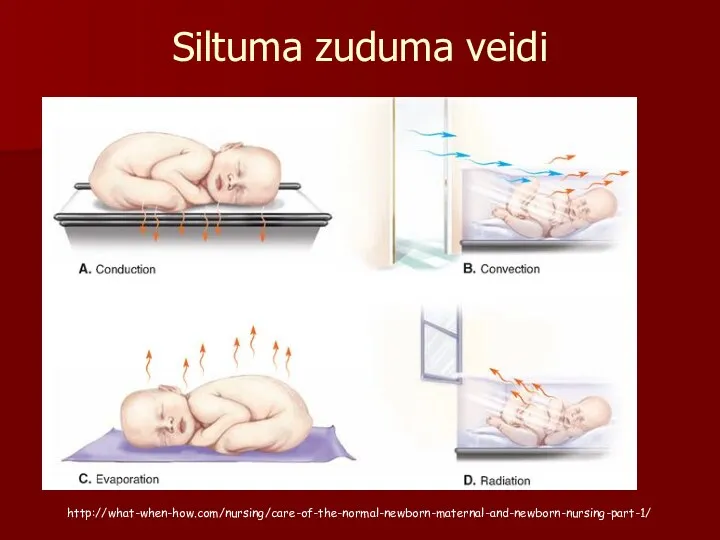 Siltuma zuduma veidi http://what-when-how.com/nursing/care-of-the-normal-newborn-maternal-and-newborn-nursing-part-1/