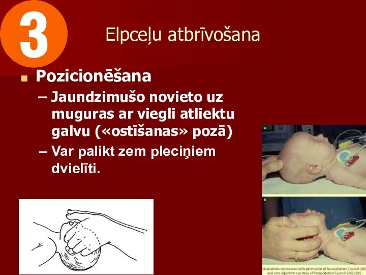 Elpceļu atbrīvošana Pozicionēšana Jaundzimušo novieto uz muguras ar viegli atliektu