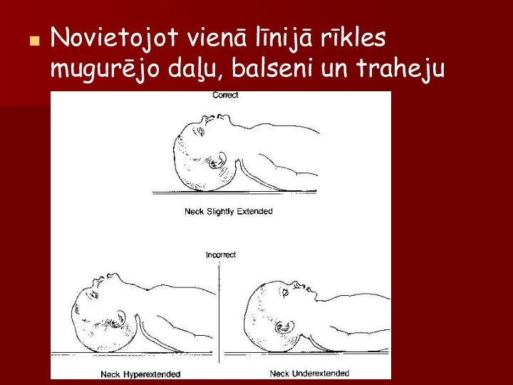 Novietojot vienā līnijā rīkles mugurējo daļu, balseni un traheju