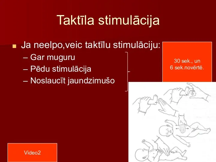 Taktīla stimulācija Ja neelpo,veic taktīlu stimulāciju: Gar muguru Pēdu stimulācija