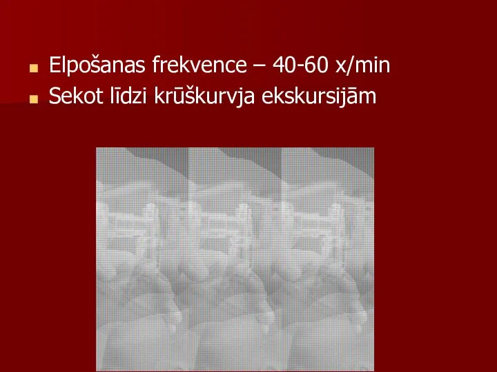 Elpošanas frekvence – 40-60 x/min Sekot līdzi krūškurvja ekskursijām