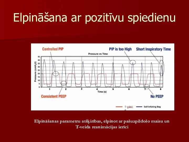 Elpināšana ar pozitīvu spiedienu T-piece Elpināšanas parametru atšķirības, elpinot ar pašuzpildošo maisu un T-veida reanimācijas ierīci