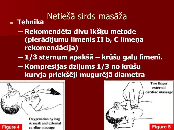 Netiešā sirds masāža Tehnika Rekomendēta divu īkšķu metode (pierādījumu līmenis