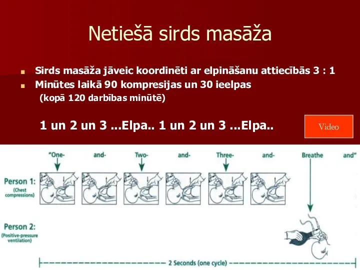 Netiešā sirds masāža Sirds masāža jāveic koordinēti ar elpināšanu attiecībās