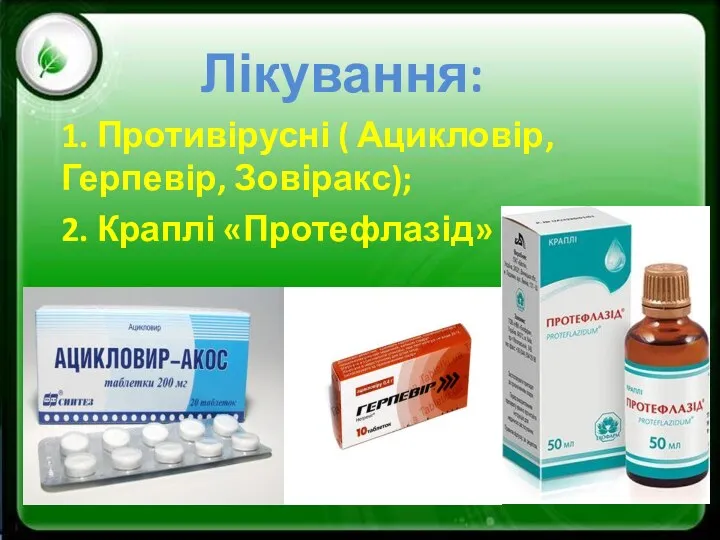 Лікування: 1. Противірусні ( Ацикловір, Герпевір, Зовіракс); 2. Краплі «Протефлазід»